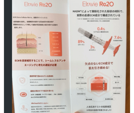 50代韓国美容レポート[ダブルMで韓国最新肌育注射Re2O ＋ドクター美で 